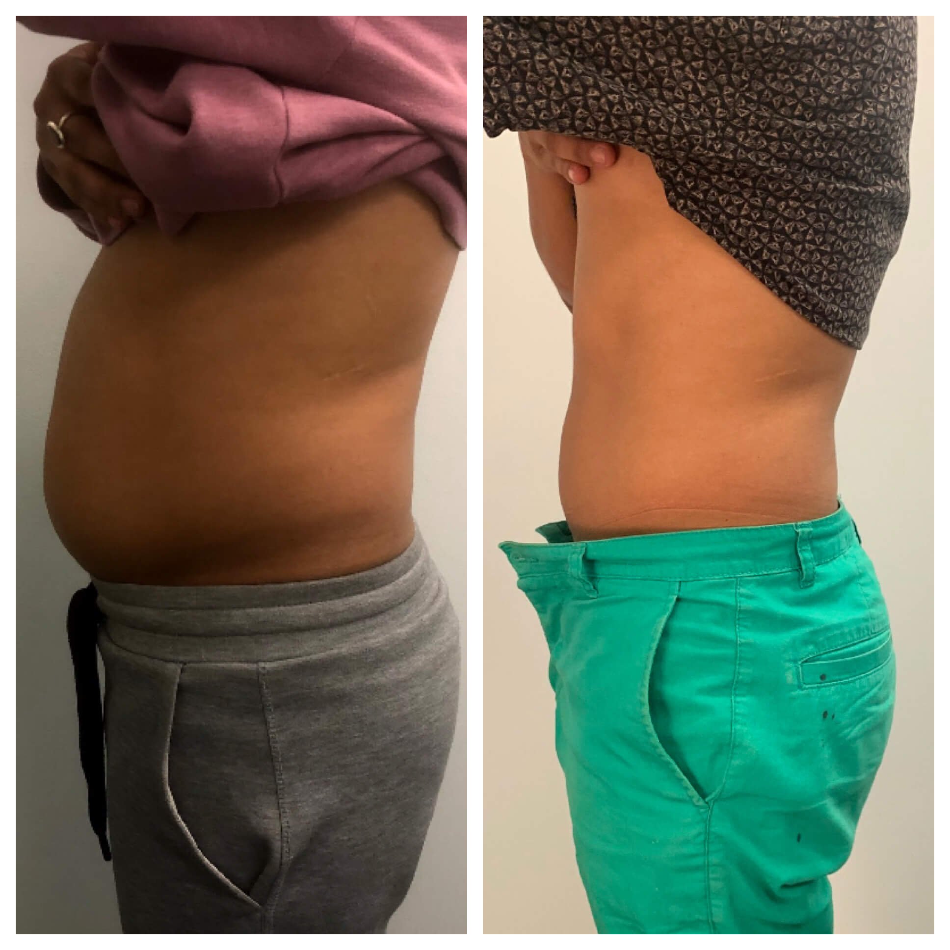 8-slimming-sessions-give-credit-to-@thrivecryostudio.jpg