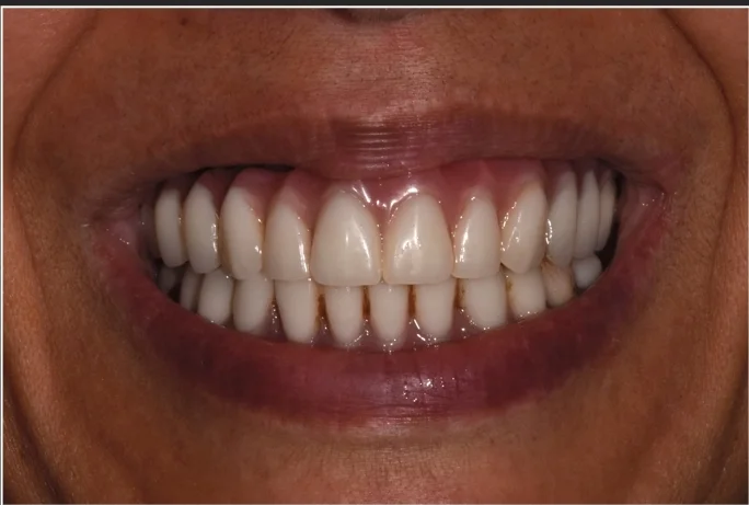 keynote-all in 6jpg.001.jpeg