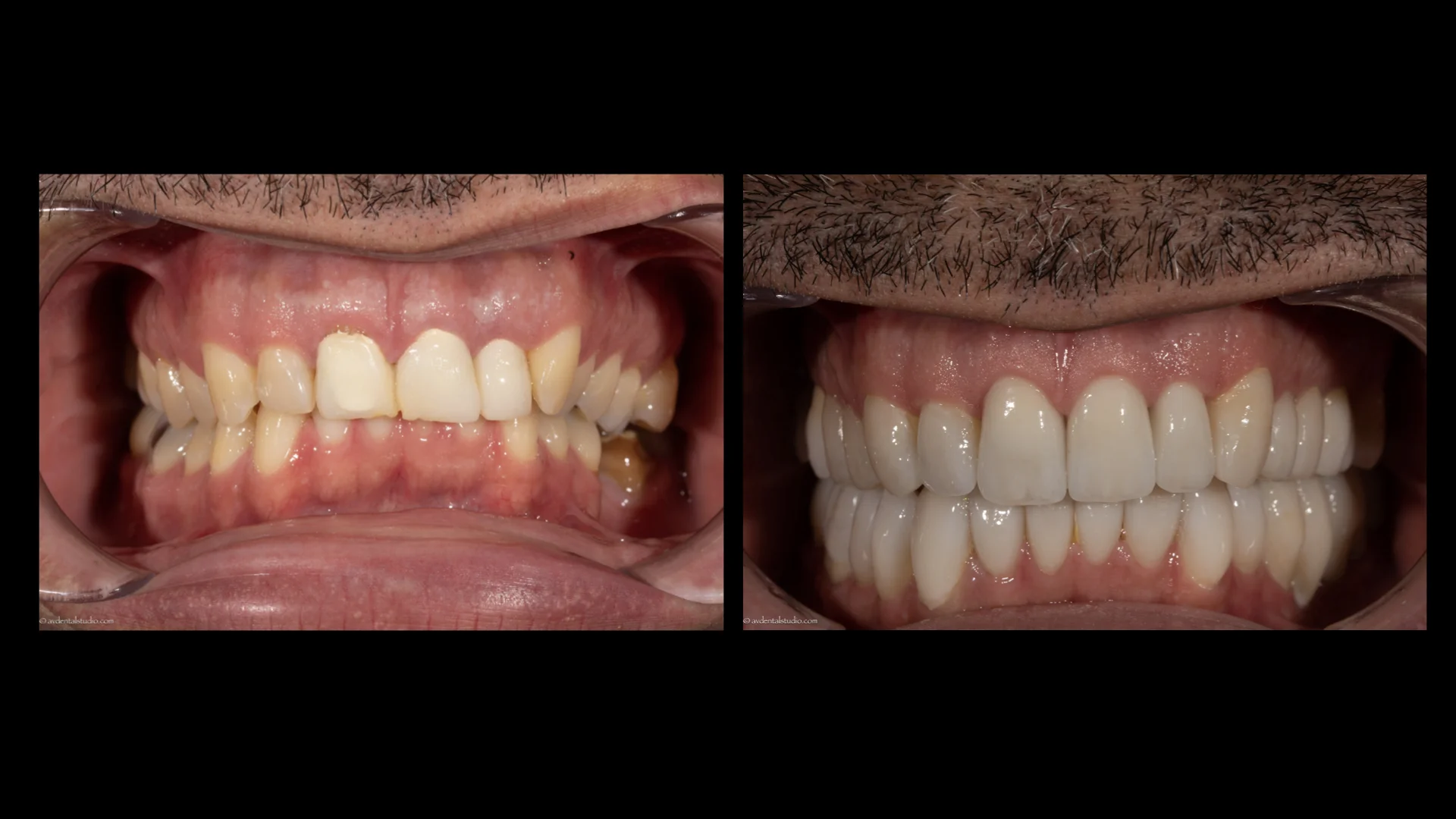 before and after.008.jpeg