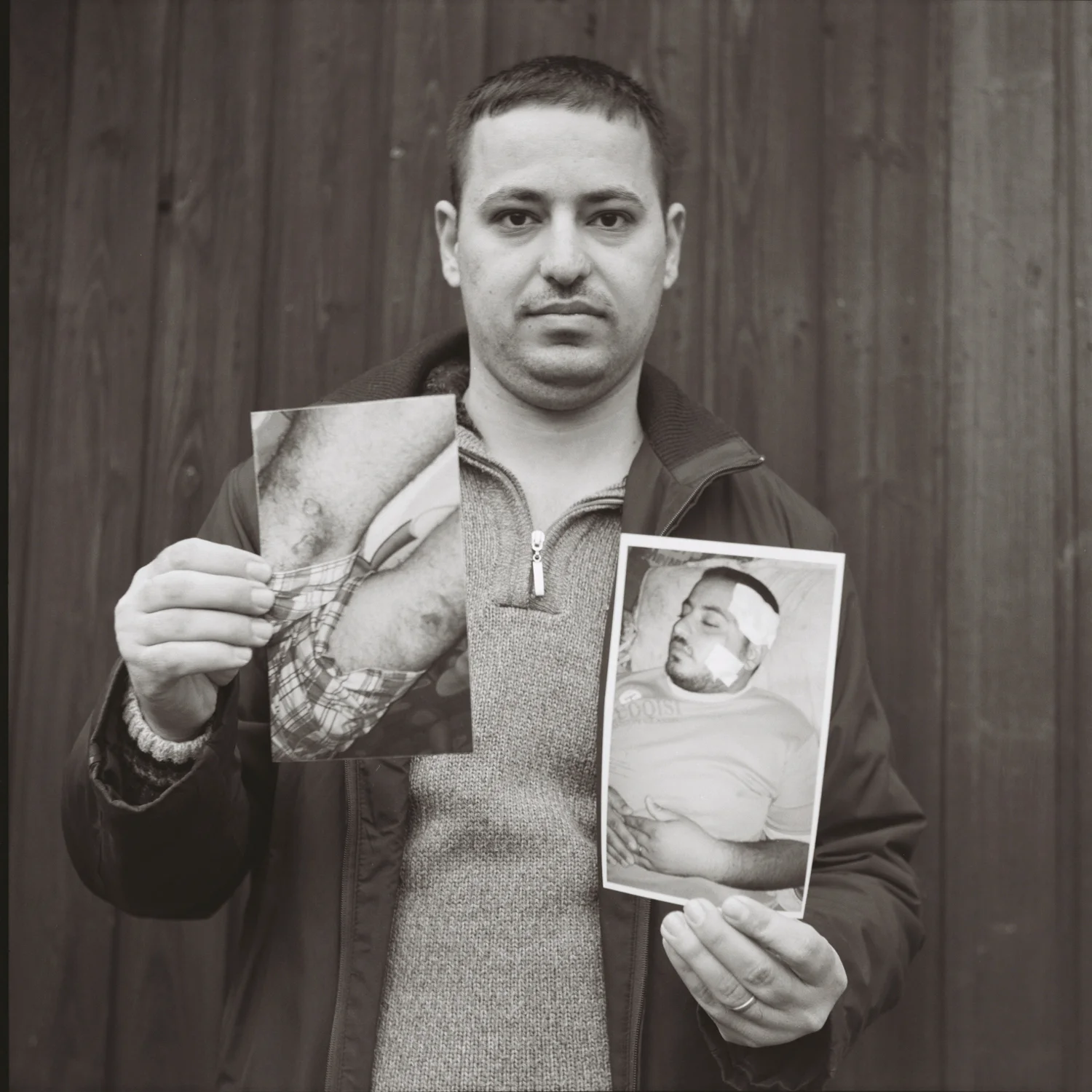 Mariam’s husband shows images of his wounds from ____. Czechia, February 2016.