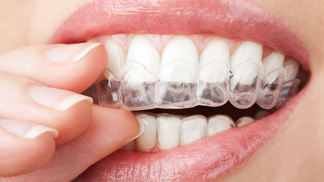 Source: Colgate.com
