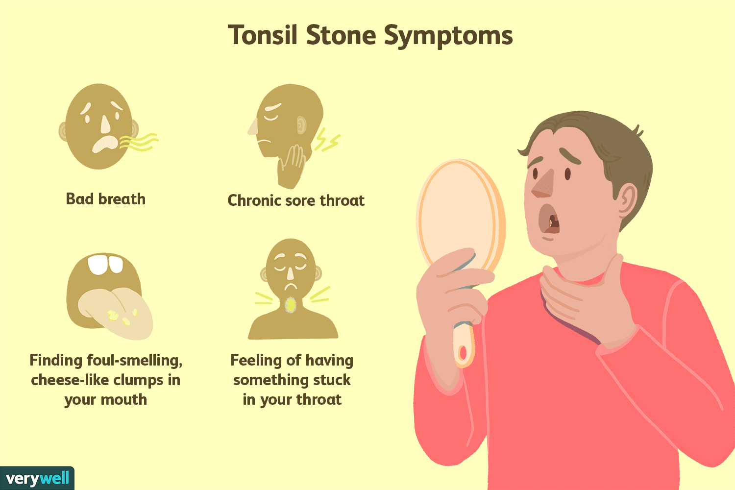 How to get rid of tonsil stones