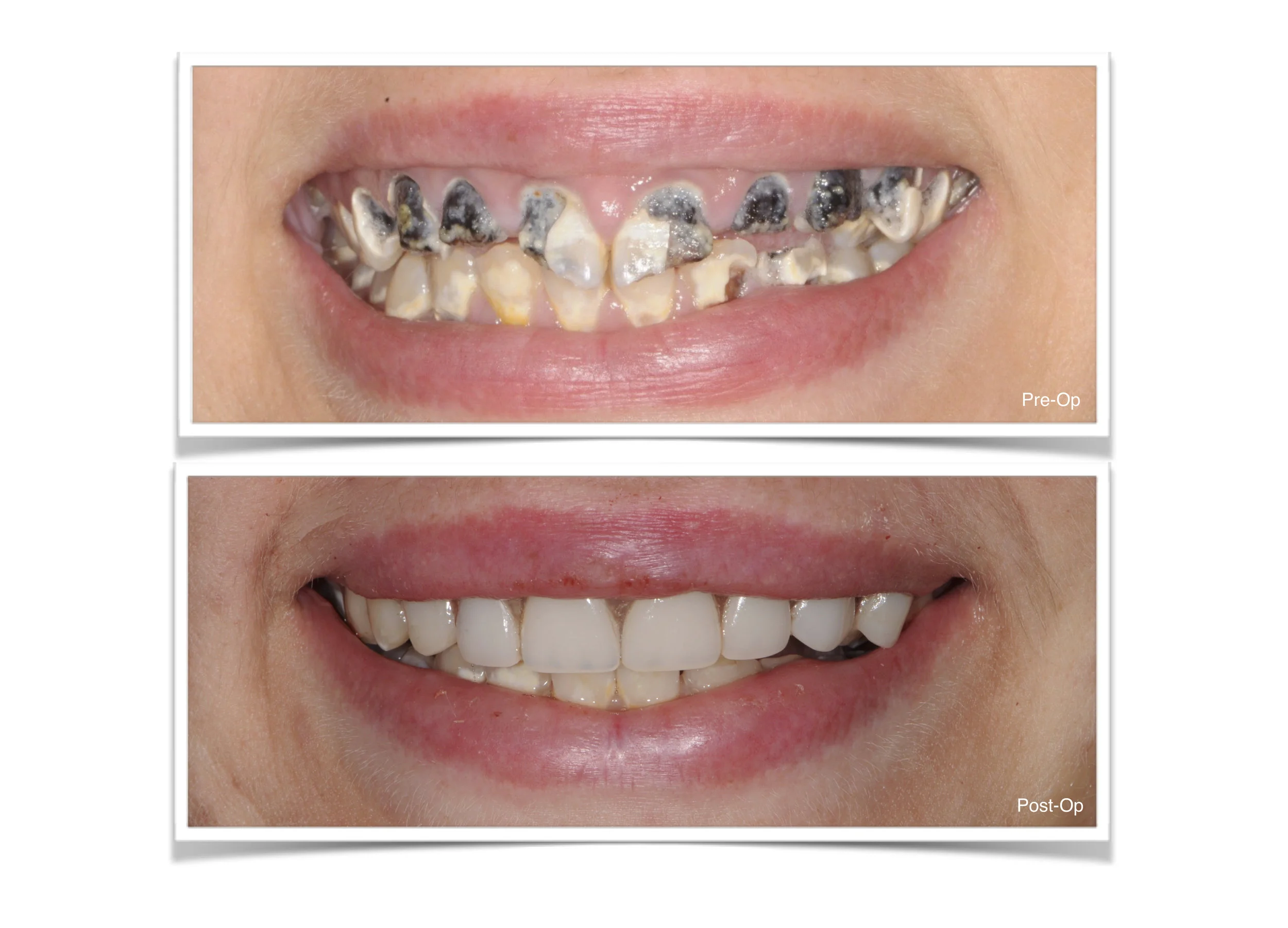 The power of a smile