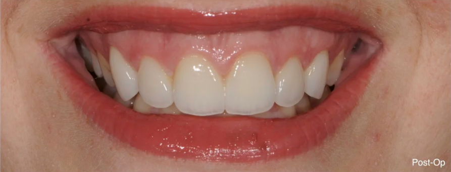 Cosmetic Dentistry Mastery: What Makes a Truly Beautiful Smile in 2026 (Expert Insights from a Jacksonville Dentist)