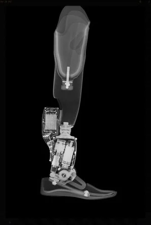 Smithsonian Hugh Herr