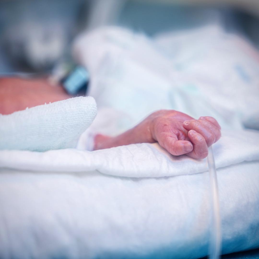 Photographed some tough things in 2016. Premature baby wards where you see tiny babies being kept alive in incubators. Survival of preemies is a huge challenge in developing countries.