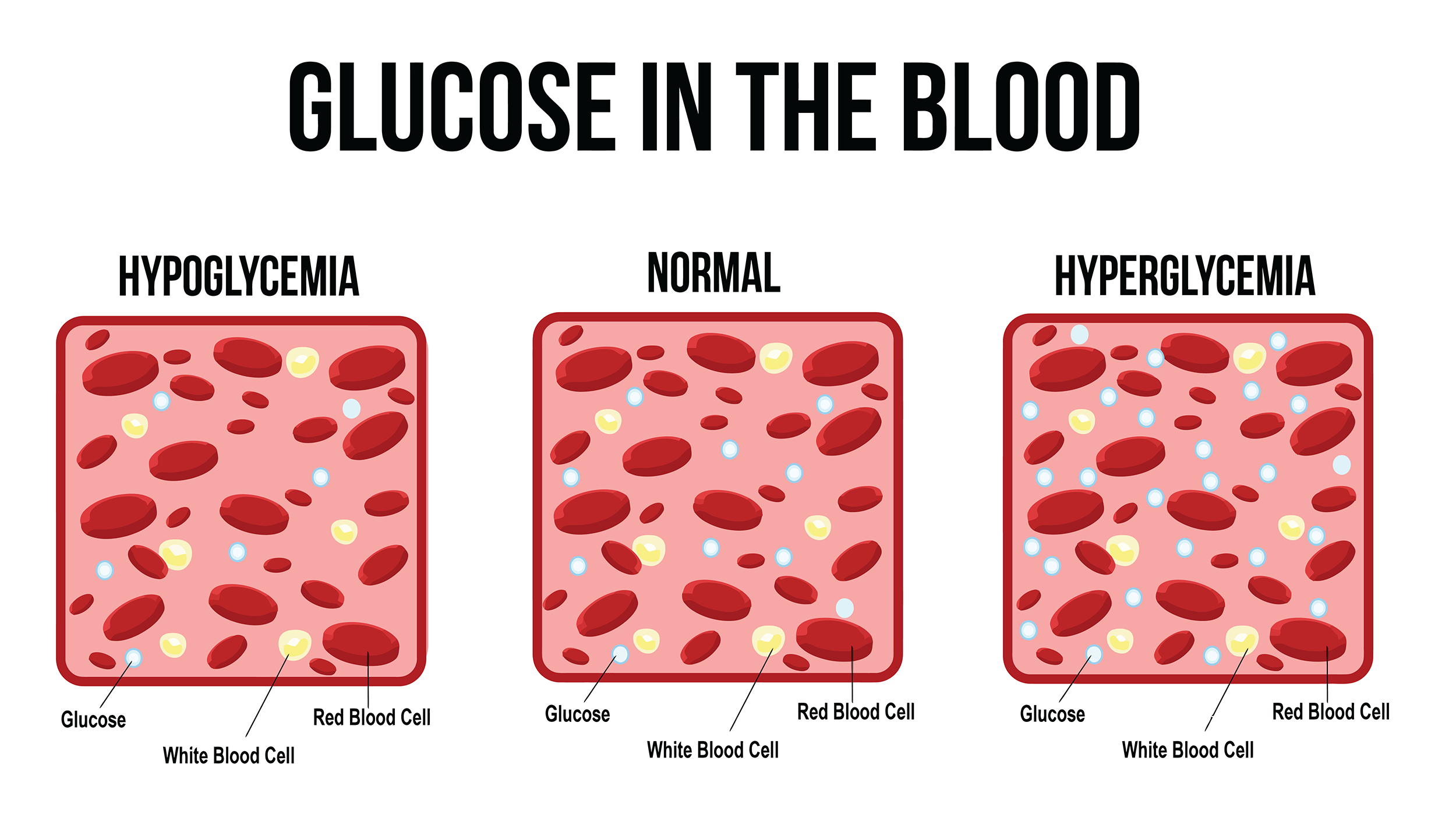  Glucose in the blood (hyperglycemia vs hypoglycemia) 