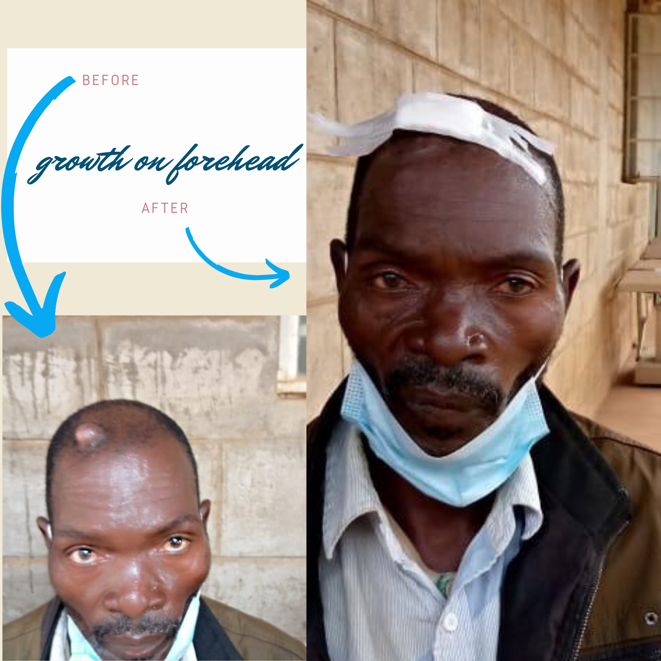 patient_before&after (1).png