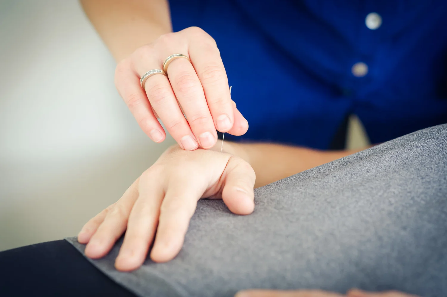 ACUPUNCTURE