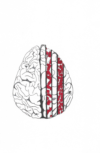 Meds for a Slice of Normality - Original 