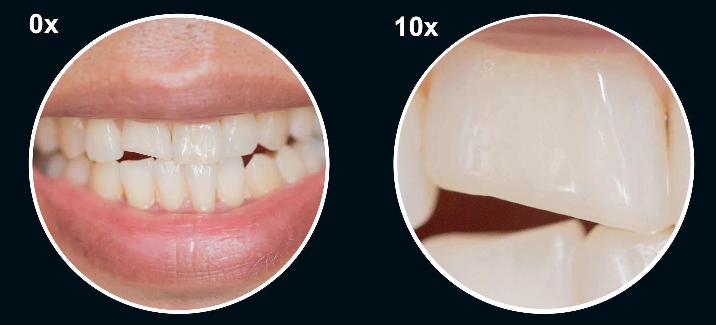 magnification-teeth-abc-dental.webp