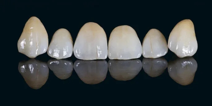 A row of six human teeth with their reflections on a glossy black surface.