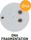 sca_dna_fragmentation_logo_english.jpg
