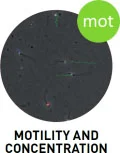sca_motility_concentration_logo_english.jpg