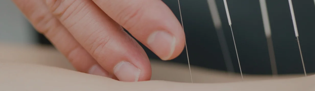 How Acupuncture Can Reduce Your Pain Medication