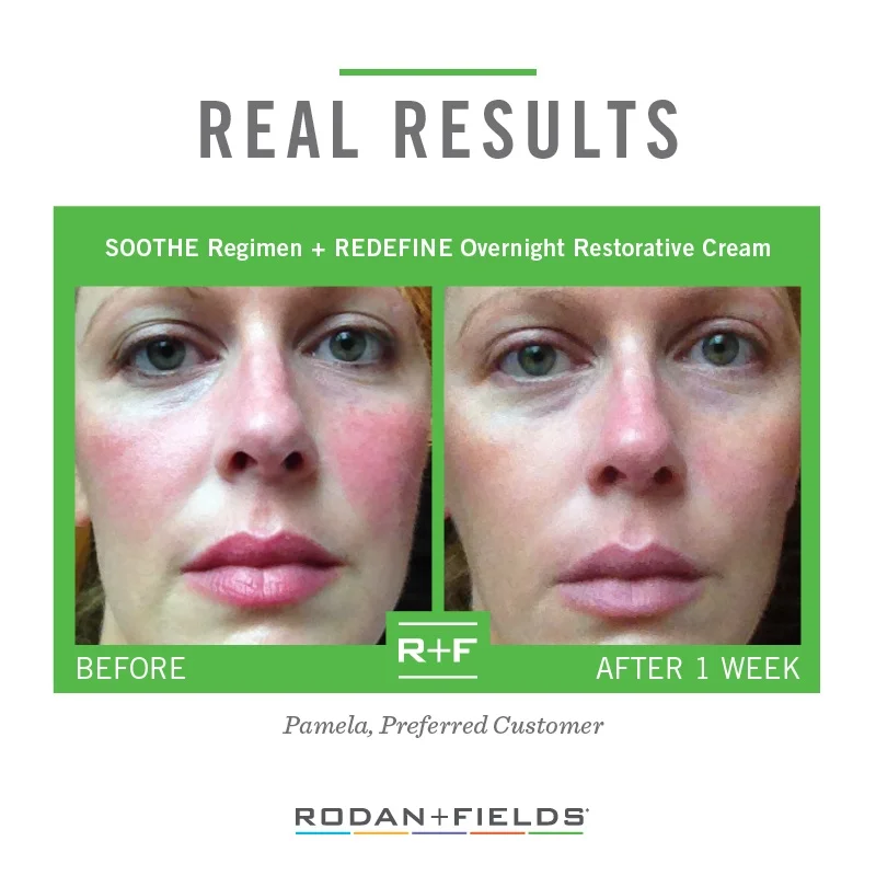 REAL RESULTS - SOOTHE + Eye Cream.jpg