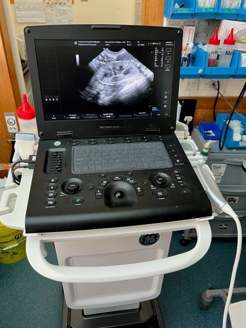 Ultrasound Scanner