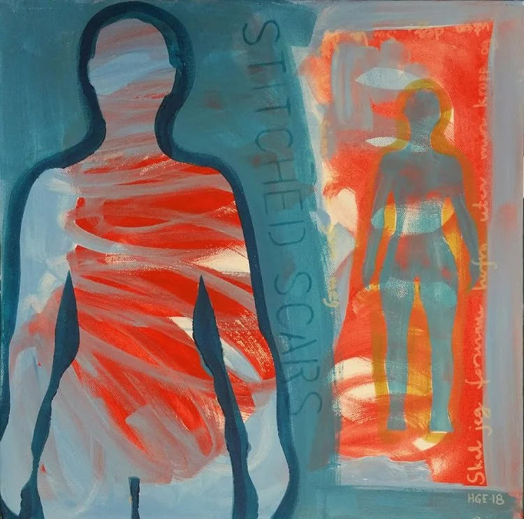 16. STICHED SCARS.jpg