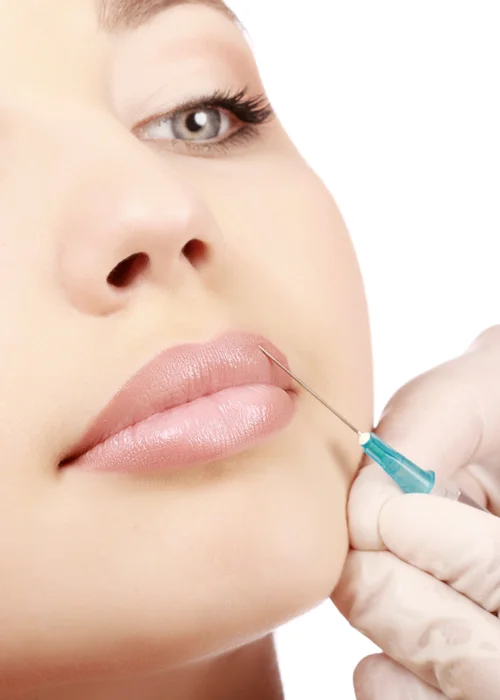 Lip Augmentation