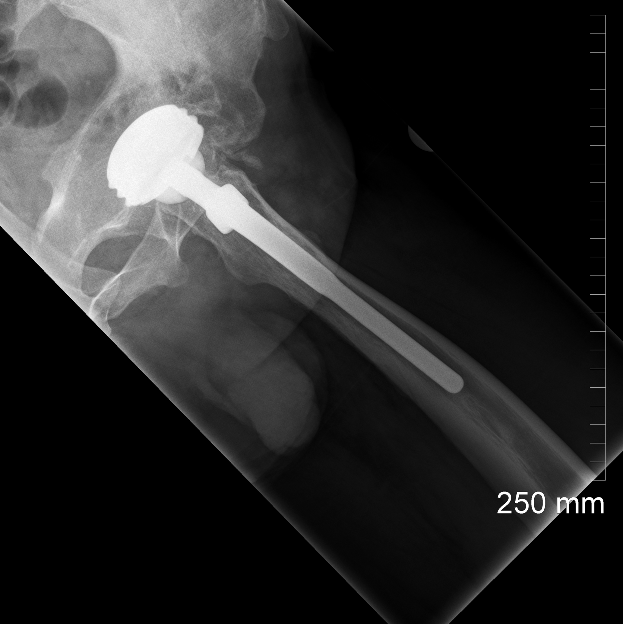 CHS-AK27 - Pre-op lateral square.png