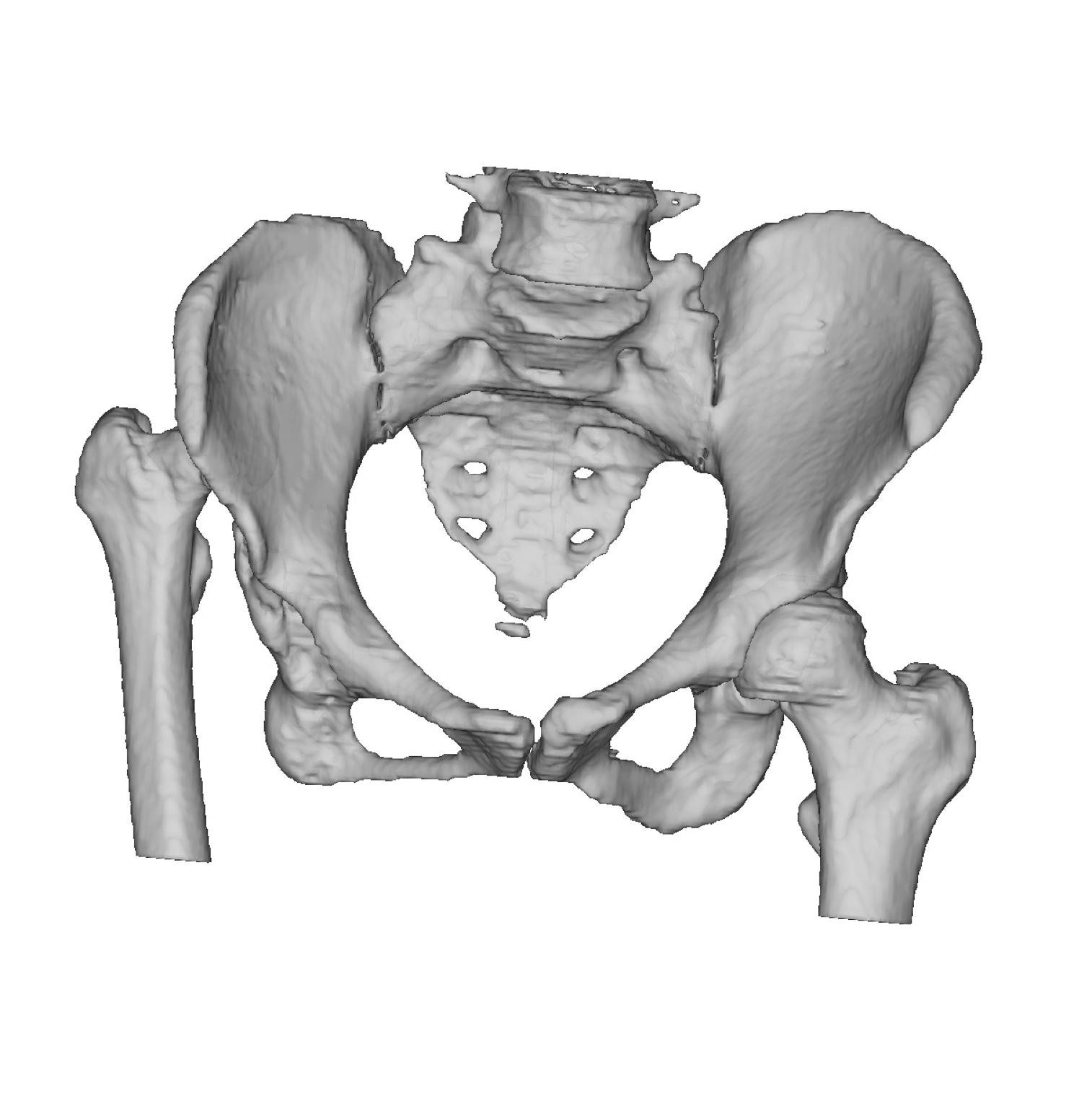 Lexi pre-op reconstruction square.png
