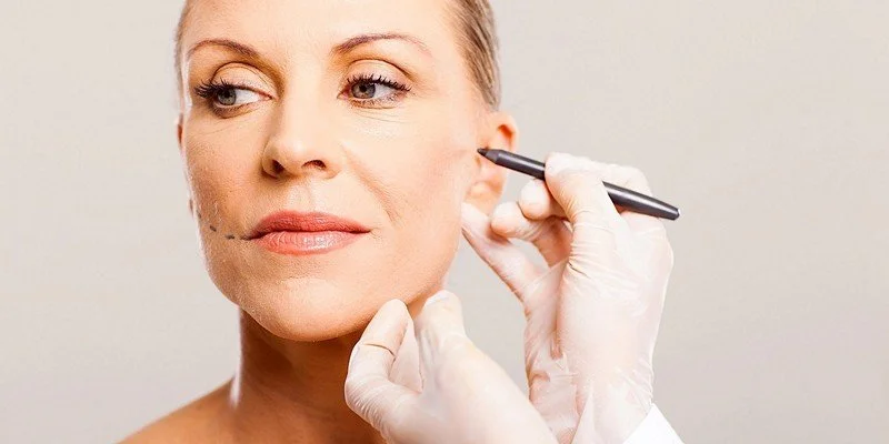 facelift.jpg