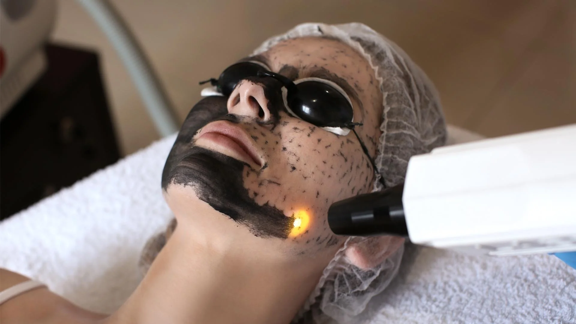 laser-peel.jpg