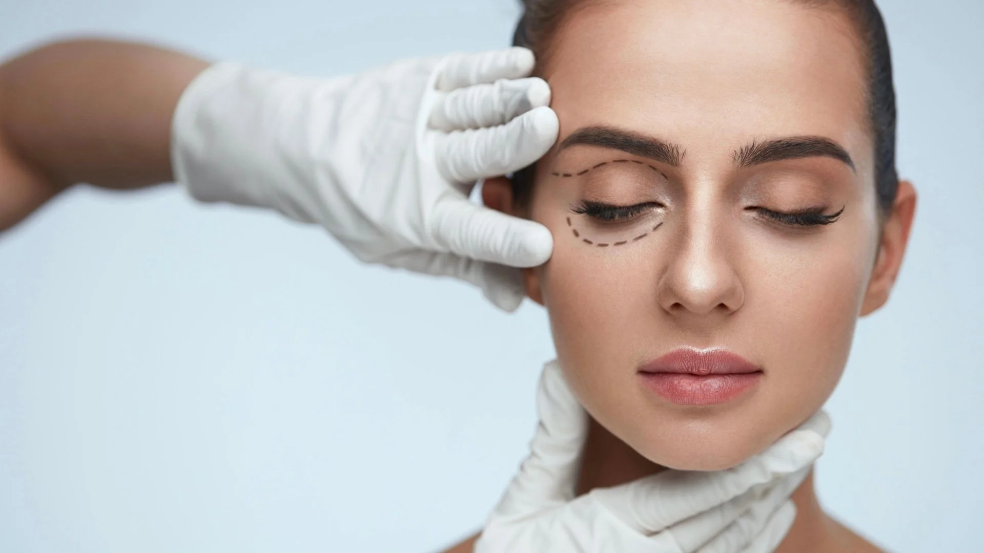 best-blepharoplasty-london.jpg