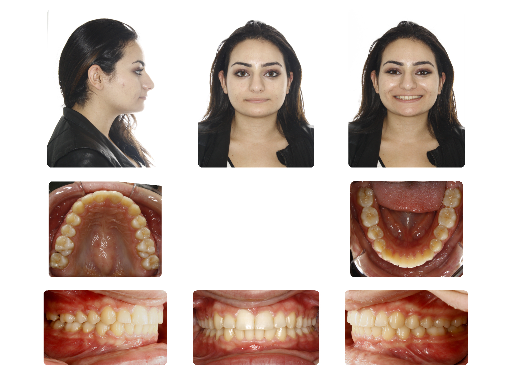After R.M finished treatment 18Yrs. Old
