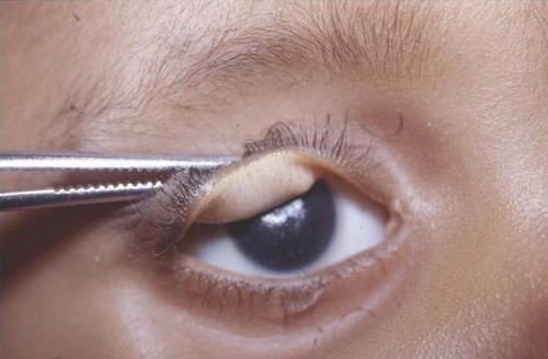 eye.png
