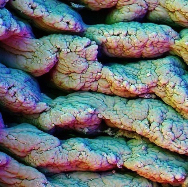 Small Intestine