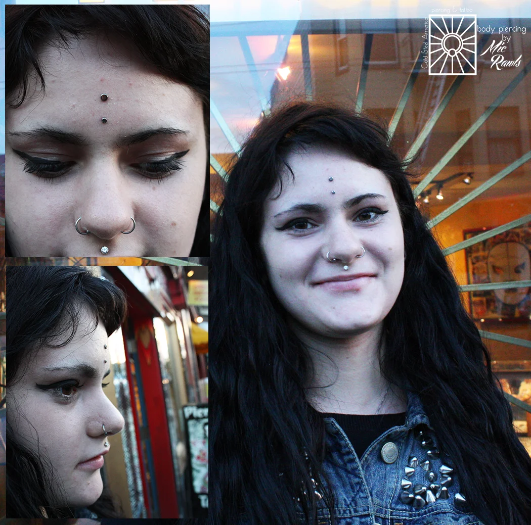 Mic did these forehead surface anchors a little over a month ago, and they are healing great! Titanium jewelry from Anatometal.
