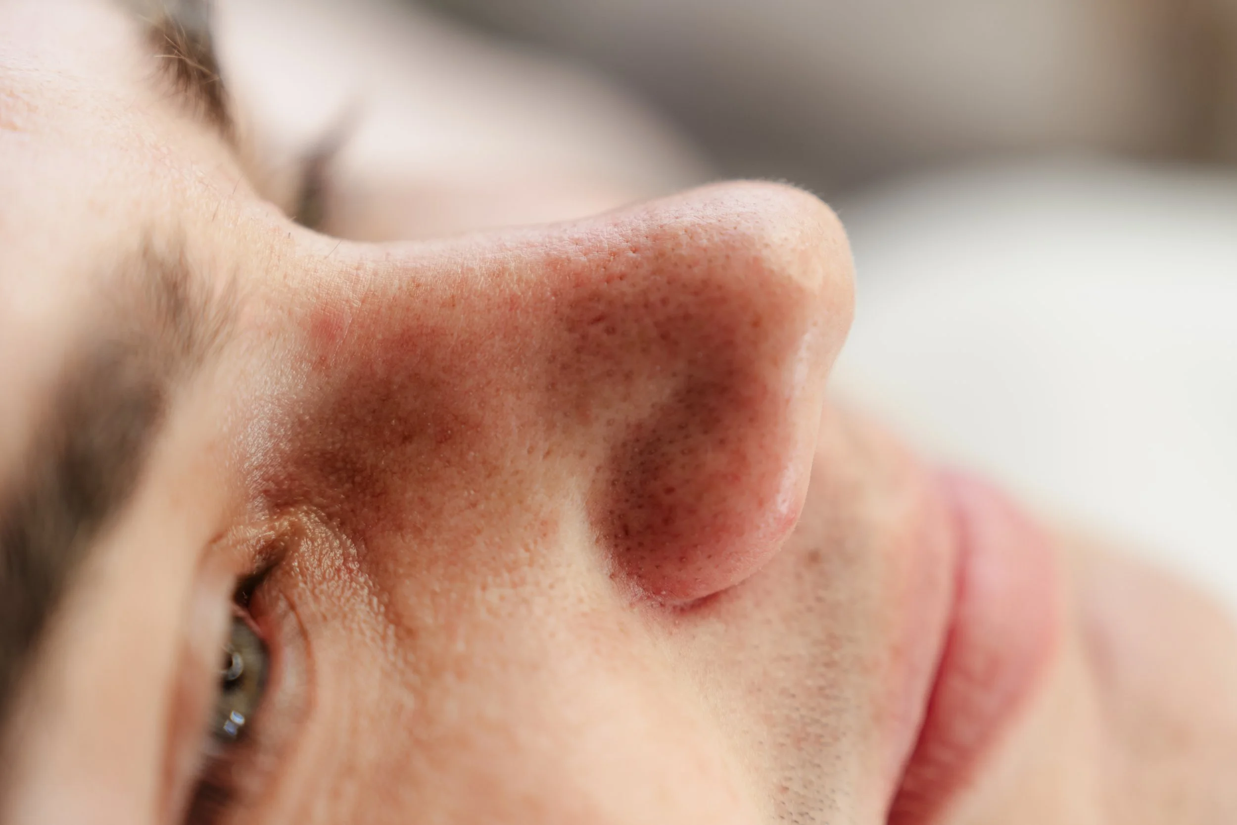 Facials in Parnell, Auckland. Your Skin Is the Only One You've Got. Let's Look After It.