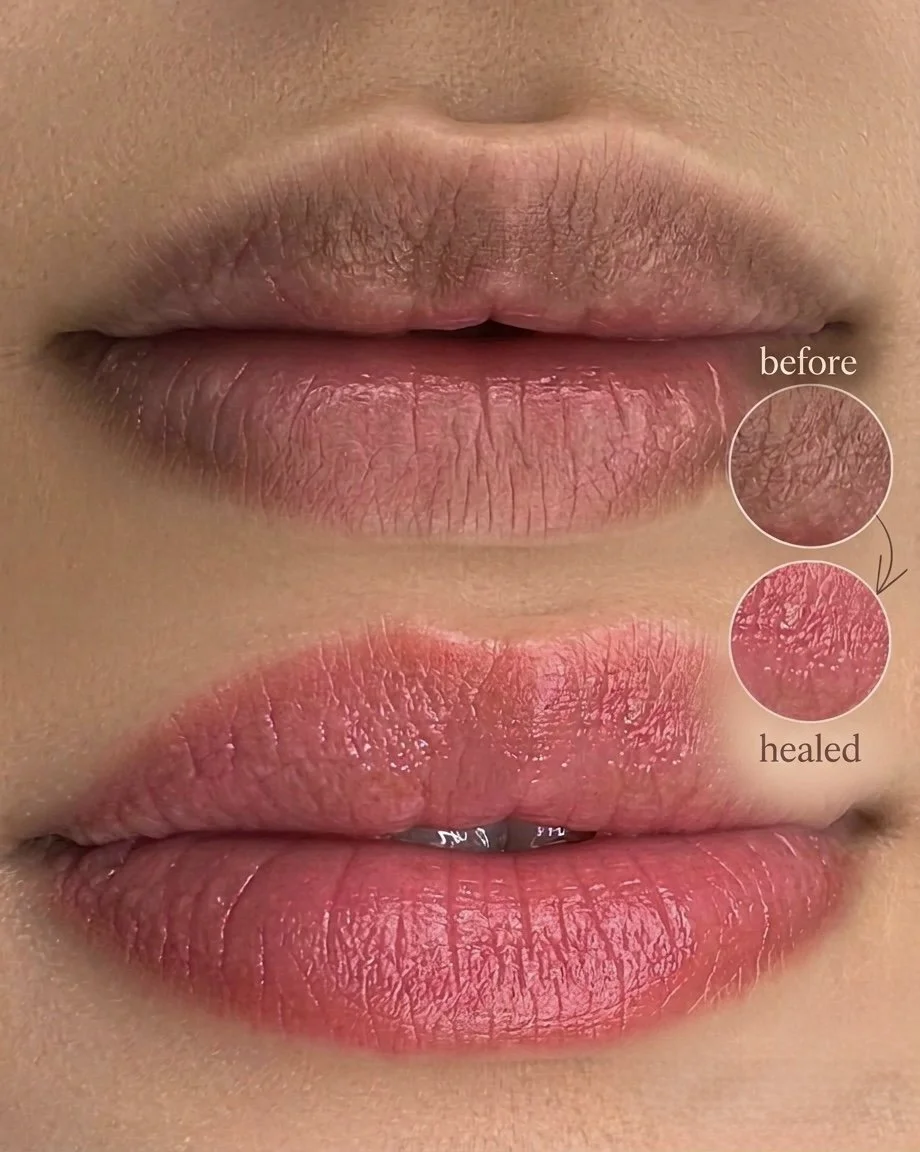   Cosmetic Tattooing: Wake Up Ready with Brows, Lips and Liner That Last