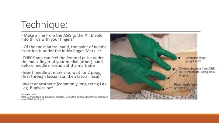 Fascia Iliaca Block — learnED