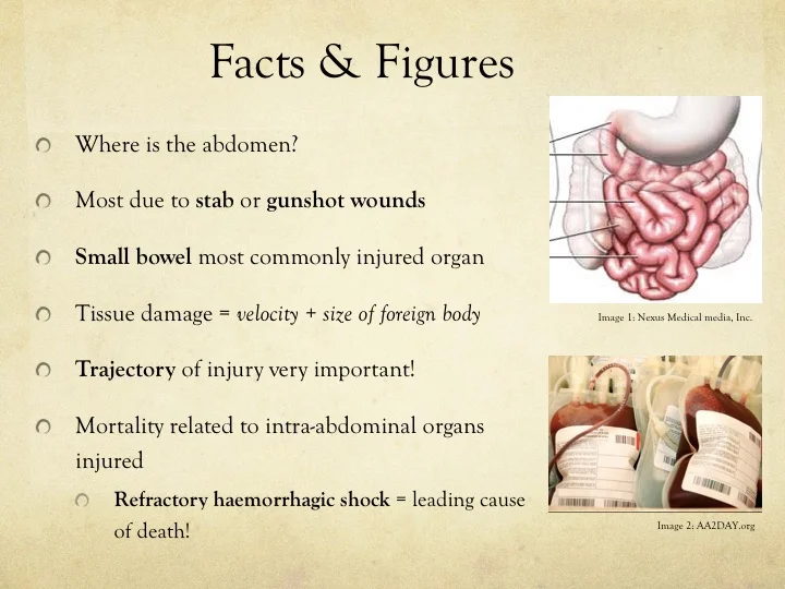 Penetrating Abdominal Trauma LearnED