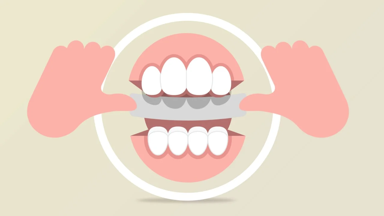 Doctors NightGuard Instructional