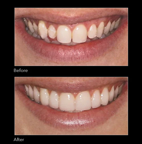 Dentistry by Dr. Paul Jacobs, Escanaba, MI