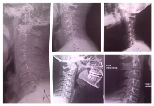 X-rays of different necks