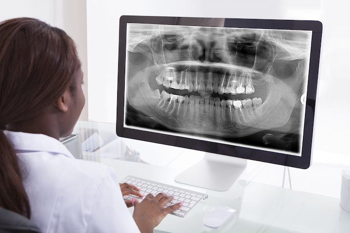 An X-ray is a photograph of the inside of your teeth. Getty Images