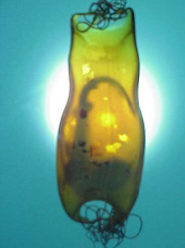 A shark developing in an egg case. Getty Images