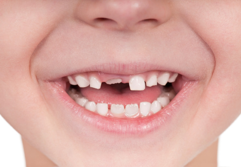 'Baby’ teeth are pushed out and are replaced by permanent teeth. © Getty Images