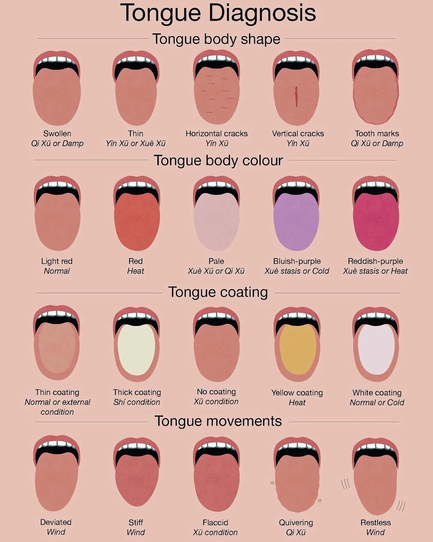 👅 T O N G U E  D I A G N O S I S 👅

I&rsquo;ve had a lot of discussions about tongues in the office recently&hellip; so here is some more info about them. 

Your tongue is a microcosm of your internal organs where each area corresponds to a differe