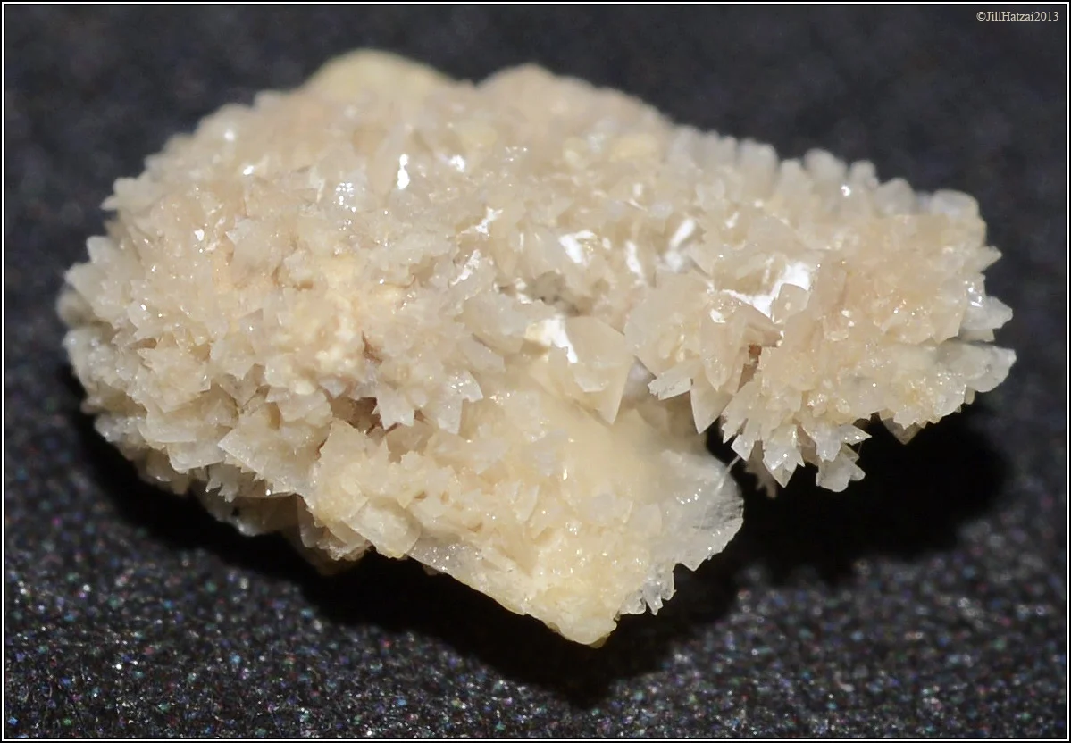 Calcium-oxylate kidney stone
