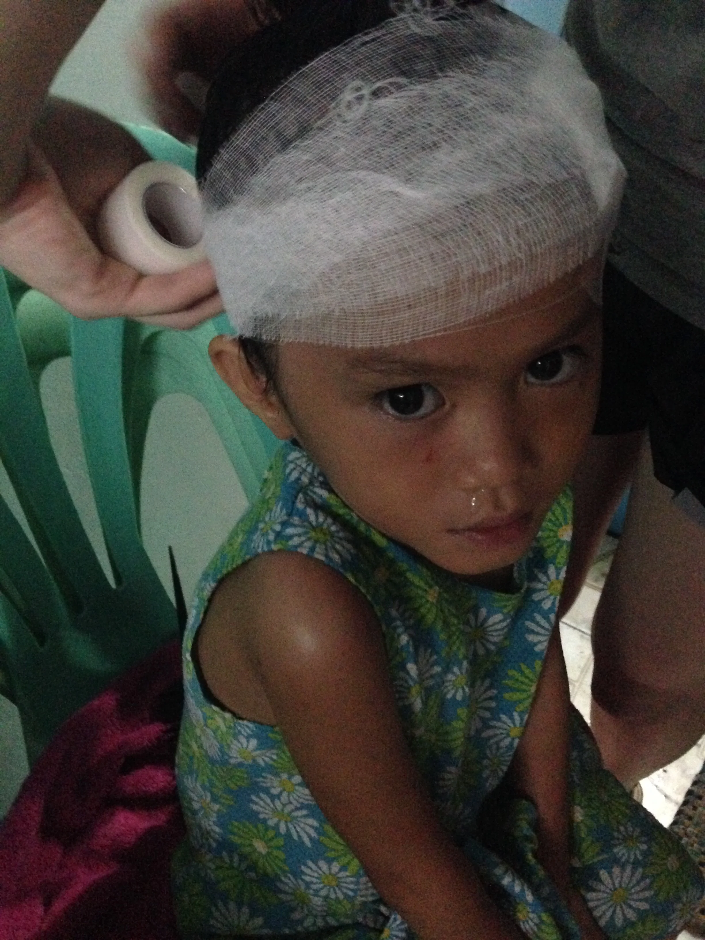 Vanessa fell out of a jeepney (Filipino public transpo) and cut her head pretty good. The infection was looking pretty gnarly. She got a thorough head scrub and several dressing changes and looked much better by the end of the week. 