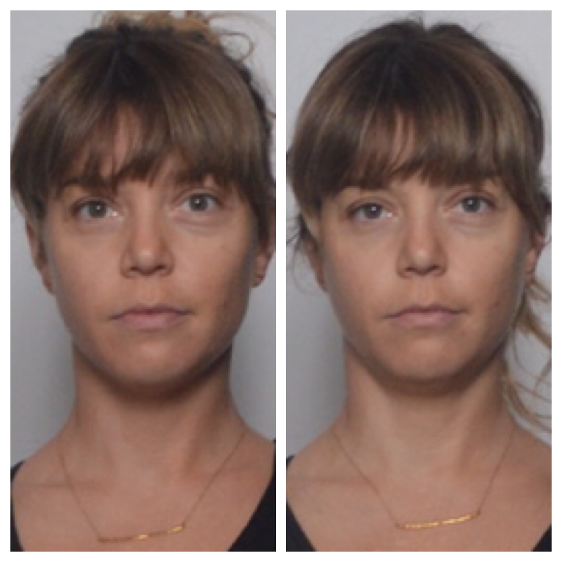 Before // After