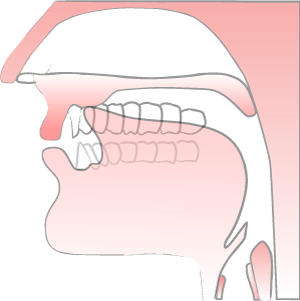 't sound' illustration