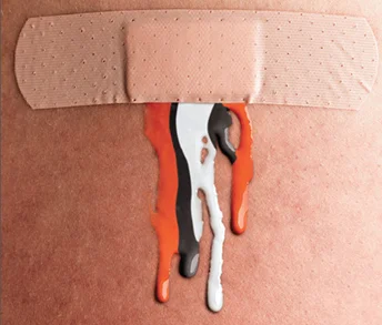 Our veins Thumbnail.jpg