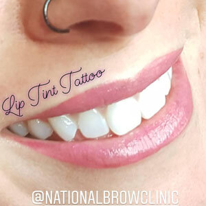 lip liner tattooing saskatoon