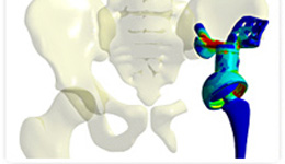 Orthopedic implants